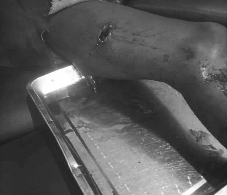 Attaque par balle d’un père sur son fils au quartier LICABO à Eseka